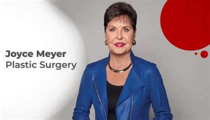 Joyce Meyer's Plastic Surgery: Uncovering The Truth