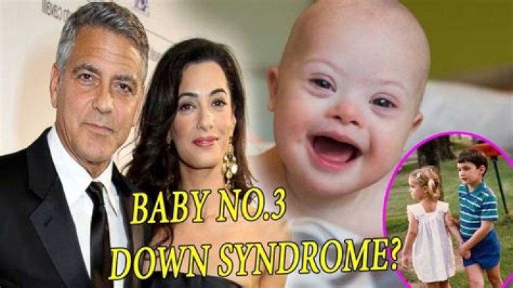 Unveiling The Facts Behind "Does George Clooney's Son Have Down Syndrome?"